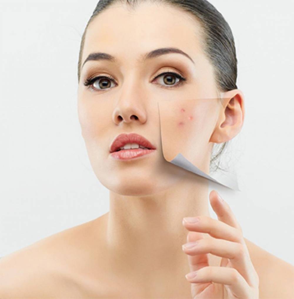 What is Medical Dermatology?